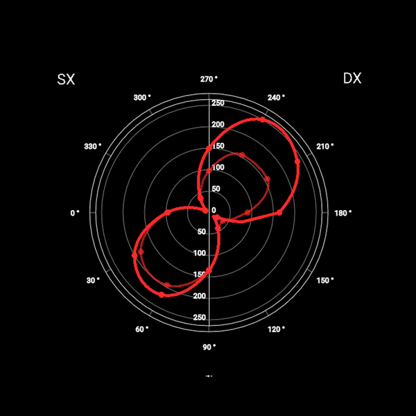 Elite Direto XR-T